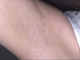 300人の腋 2　サンプル画像19